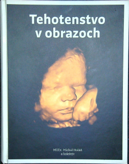 Tehotenstvo v obrazoch